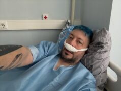 Лебедев сделал септопластику: как дизайнер перенёс операцию на носу