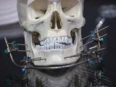 Врач объяснила, может ли ношение брекетов состарить лицо человека